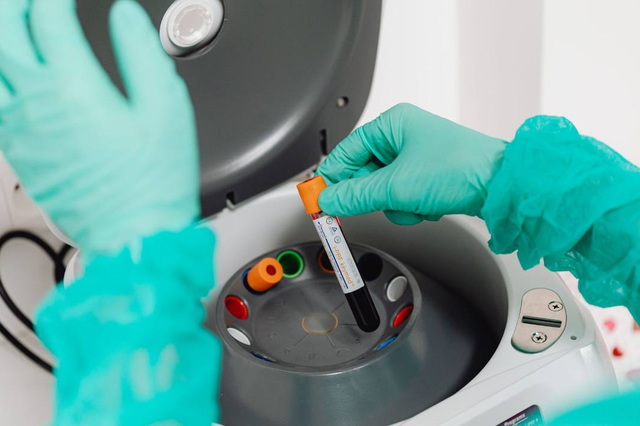 Эпидемическая ситуация: заболеваемость ОРВИ уменьшается