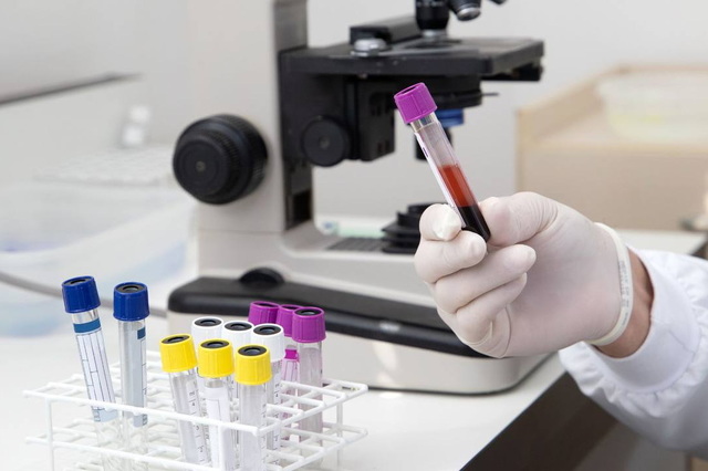 Епідемічна ситуація в області: від грипу померла людина