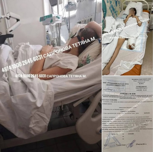 Известная днепровская адвокат будет защищать интересы девочки, которой ампутировали ногу после нападения собаки