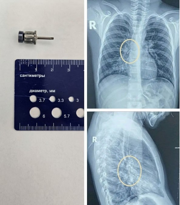 ����������� ������ ������� ����� �� ���������� ������� ��������� � ���������� � ��������