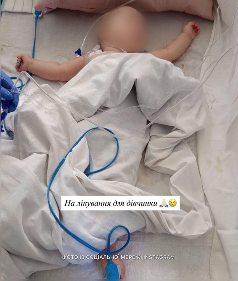 На Днепропетровщине спасают 9-месячную девочку, раненную вражеским «Шахедом»
