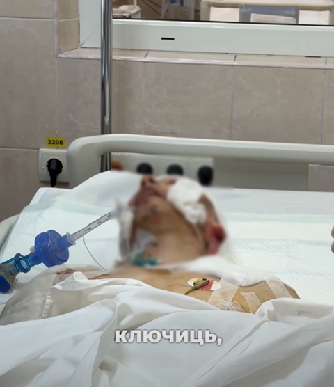 У Дніпрі рятують мирних мешканців області, які постраждали від ворожих атак