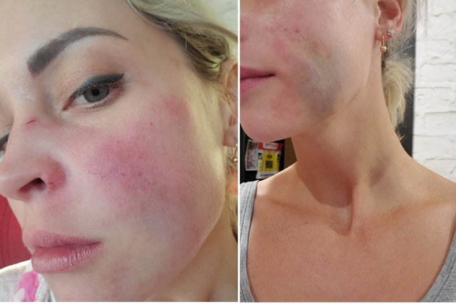 Жительницу Днепра сбил водитель, который имел суммарно более 17 лет запрета на вождение