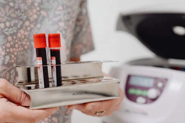 Эпидемиологическая ситуация на Днепропетровщине: Ситуация с COVID-19 продолжает улучшаться