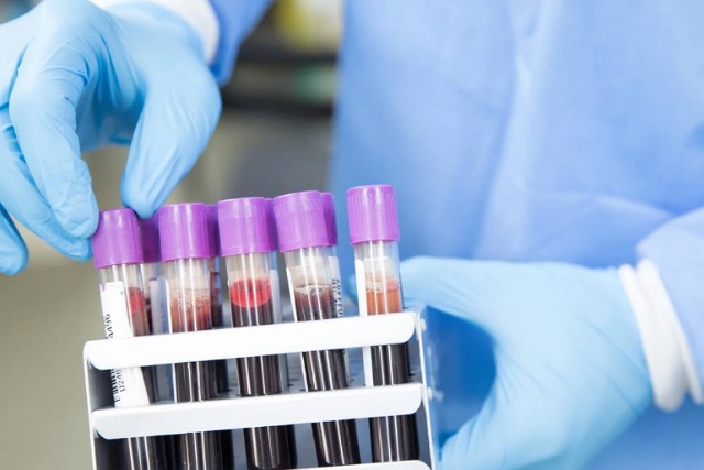 Эпидемическая ситуация в области: возросло количество заболеваний ОРВИ